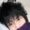 走形蔑Ⅹvs甲亢伤情